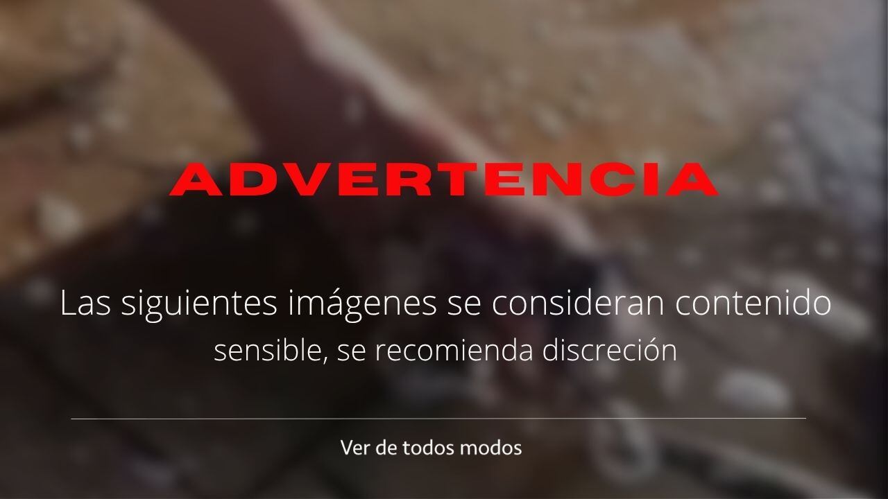 El caso de miasis atribuido al gusano barrenador generó consternación en redes sociales.
