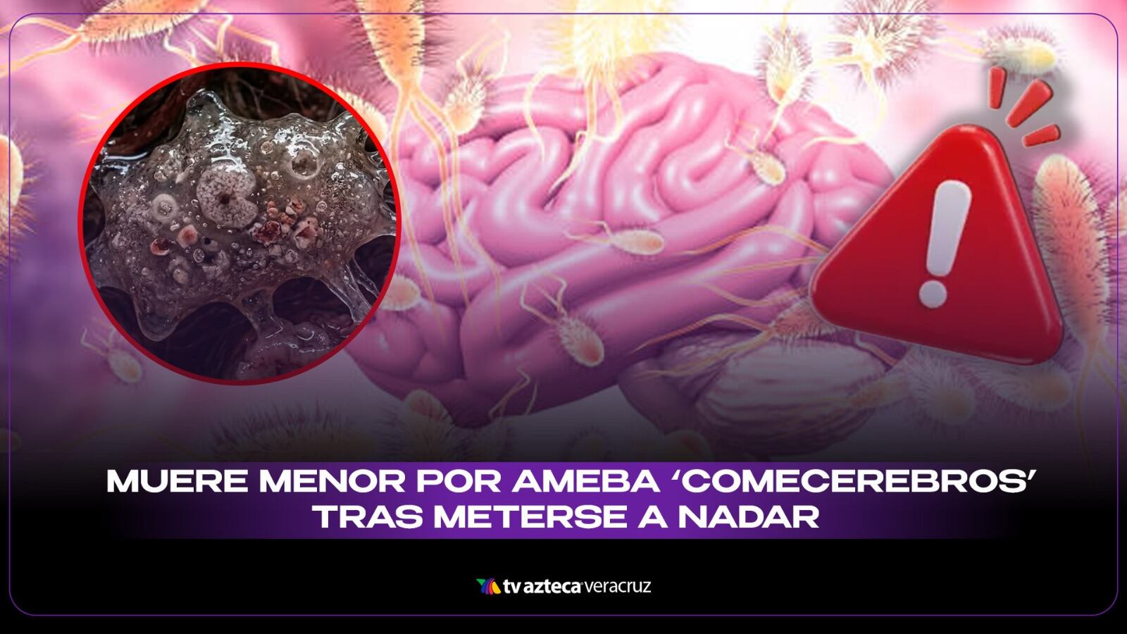 Muere menor por ameba 'comecerebros' tras meterse