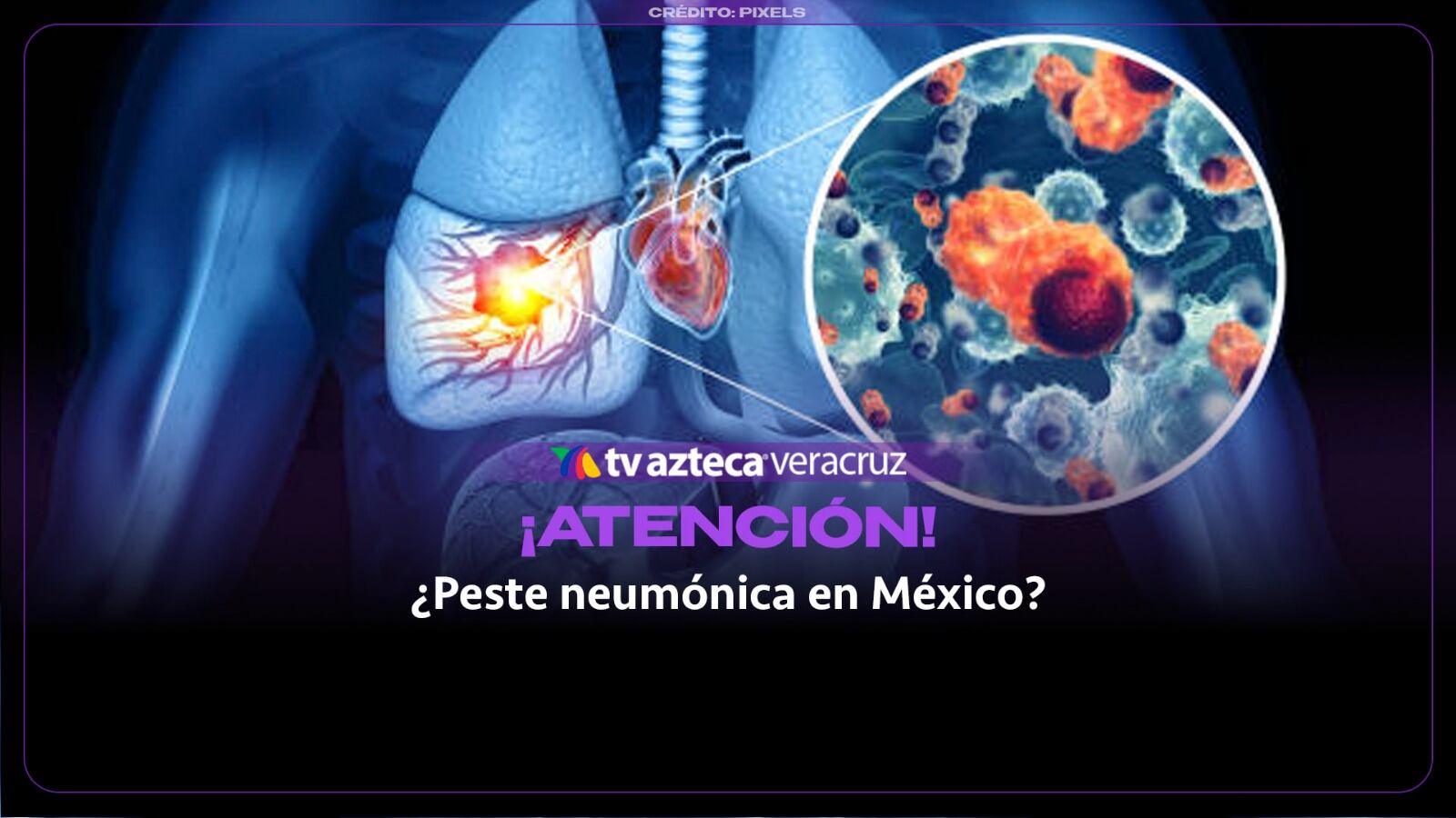 ¿La peste neumónica podría llegar a México? Esto se sabe del riesgo de nueva pandemia