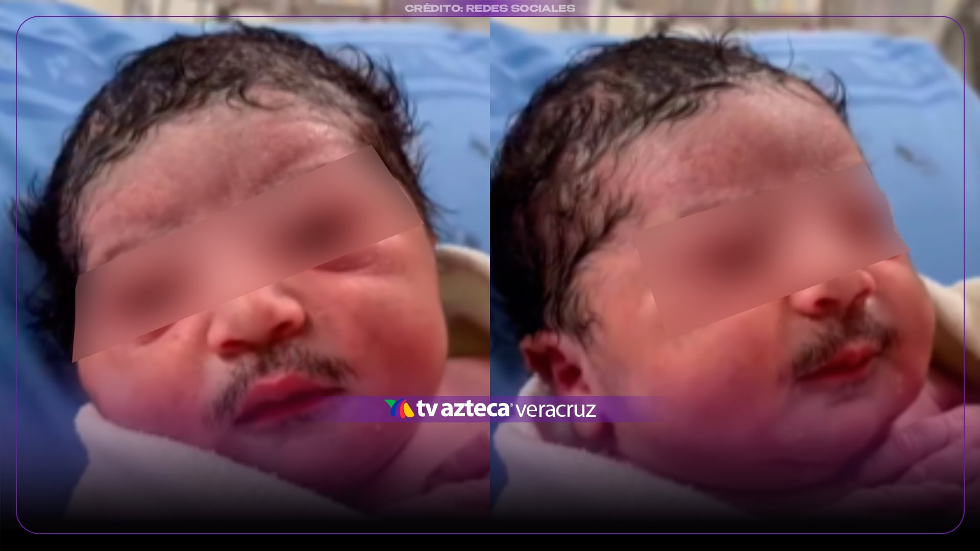 ¡TIENE BIGOTE! Bebé recién nacido rompe el internet por su CURIOSO aspecto | +VIDEO