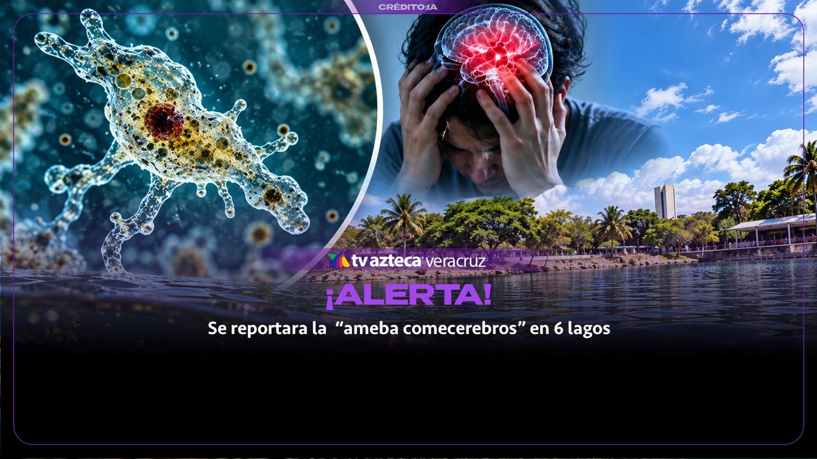¡ALERTA! ‘AMEBA COMECEREBROS’ causa una MUERTE y es detectada en varios lagos; ¿hay riesgo en Veracruz?