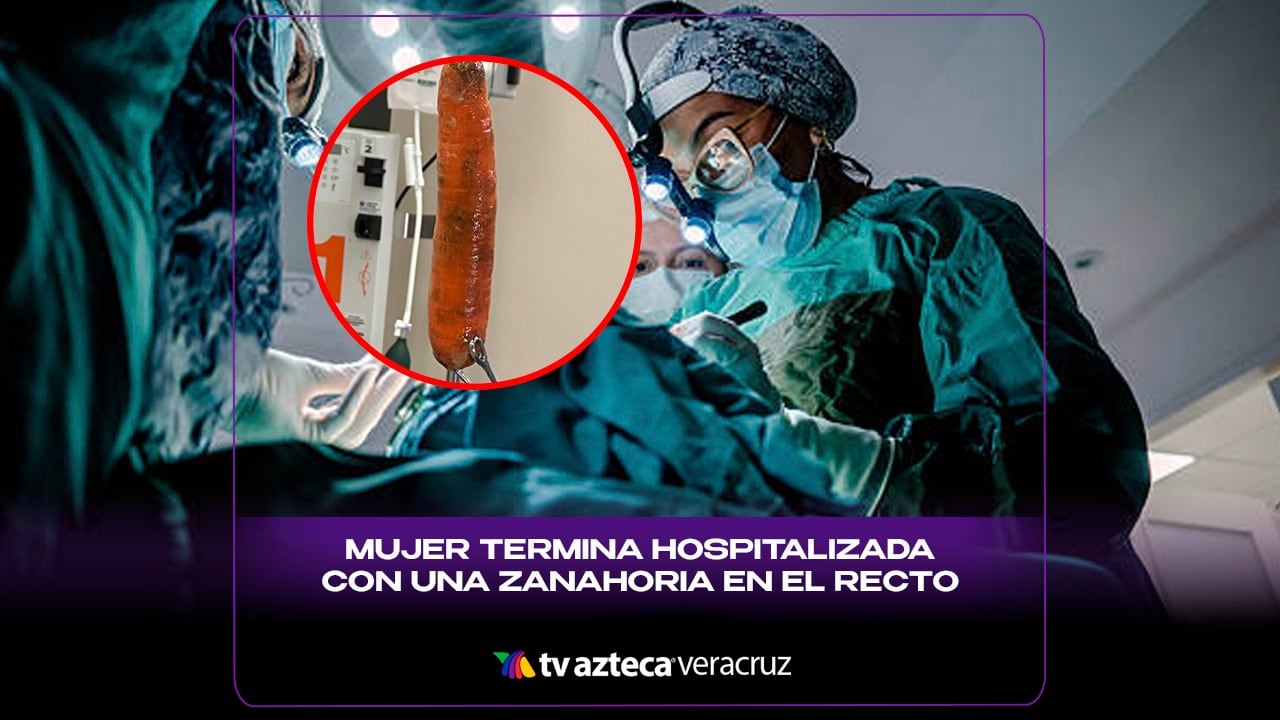 ¡IMPACTANTE! Mujer termina hospitalizada tras PERMANECER 3 DÍAS con una ZANAHORIA en el RECTO; así ocurrió
